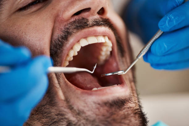 Best Emergency Dental Care for Trauma or Injury in Villas, NJ