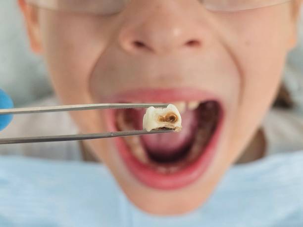 Best Emergency Treatment for Toothache in Villas, NJ